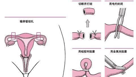 女性小便后要不要擦？首先，纸巾得用对缩略图